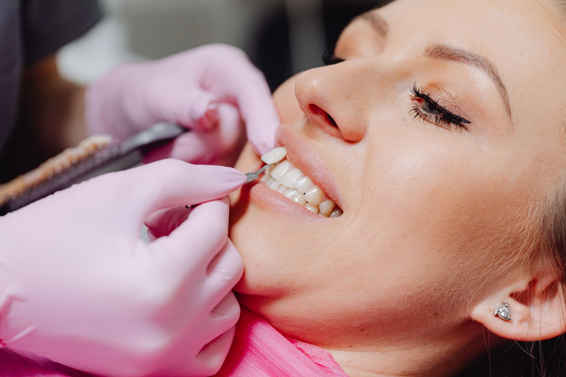 A dentist matching a tooth shade with a patient during a cosmetic appointment
